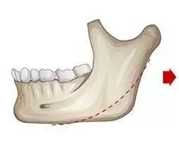 男生自己剪寸头怎么弄,男生剪寸头意味着什么