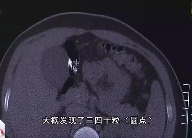 16岁男孩喝珍珠奶茶丧命,为什么小孩喝珍珠奶茶恶心呕吐