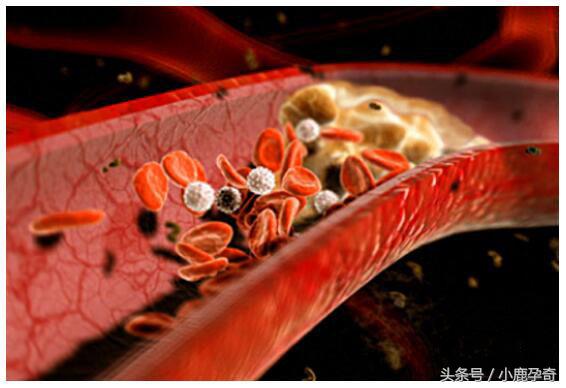 胆固醇高吃辅酶q10有降低胆固醇吗,胆固醇高血脂高要注意哪些饮食