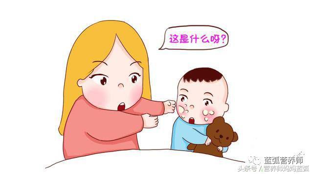 怎么判断孩子斑点是不是白癜风,宝宝身上长白斑是缺什么