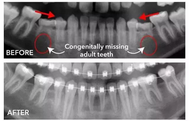 孩子爱问父母问题,孩子换牙期这些事家长必须要知道