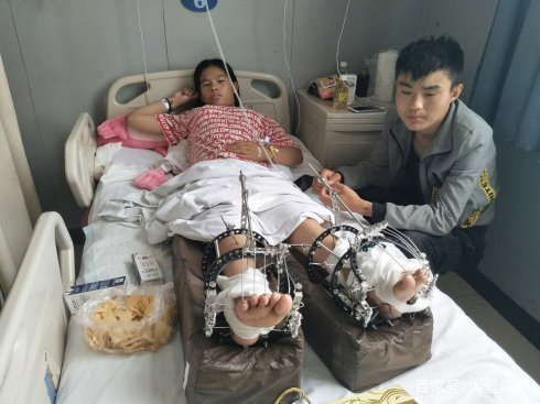 不要怕！先天脊柱裂花季女孩，我们帮你站起来！