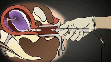 一组动图警示你,一组动图警示你绝望的操作