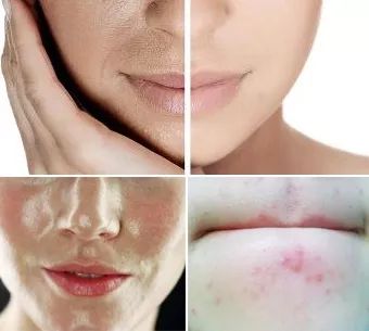 断货半年，抢都抢不到！荣登Cosme榜首，用完肌肤嫩到爆