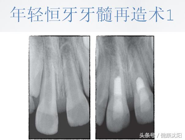 健康科普牙科,健康科普口腔科普