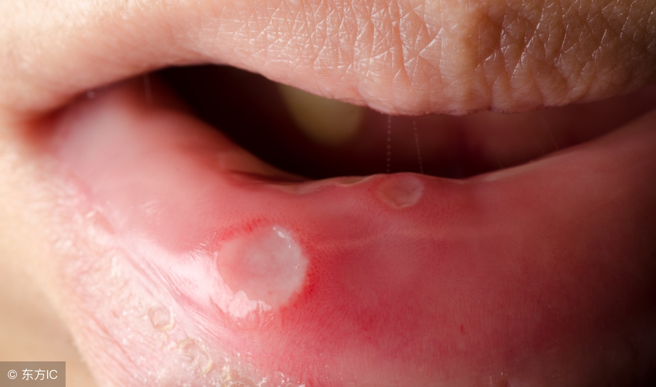 风油精孕妇可以用吗？它还有哪些不为人知的用途？