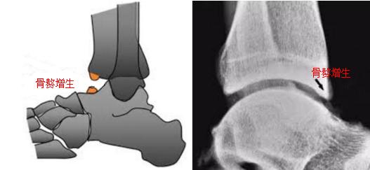 世界杯足球热场,世界杯足球护踝
