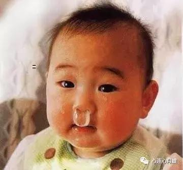 宝宝着凉流鼻涕发热小妙招,宝宝流清鼻涕发烧的最快治疗方法