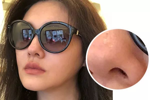 林允谈黑自己视频,林允自曝圈内现象