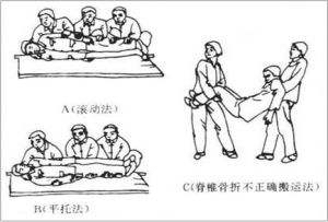 骨科肋骨骨折,中医骨科骨折