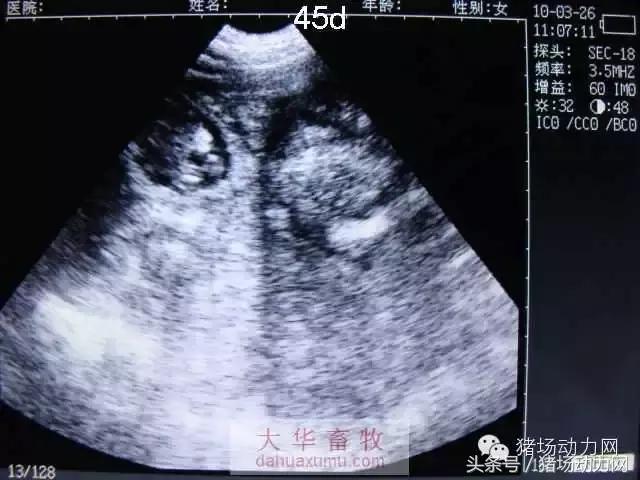 母猪b超图像如何看,怀孕100天的母猪b超影像