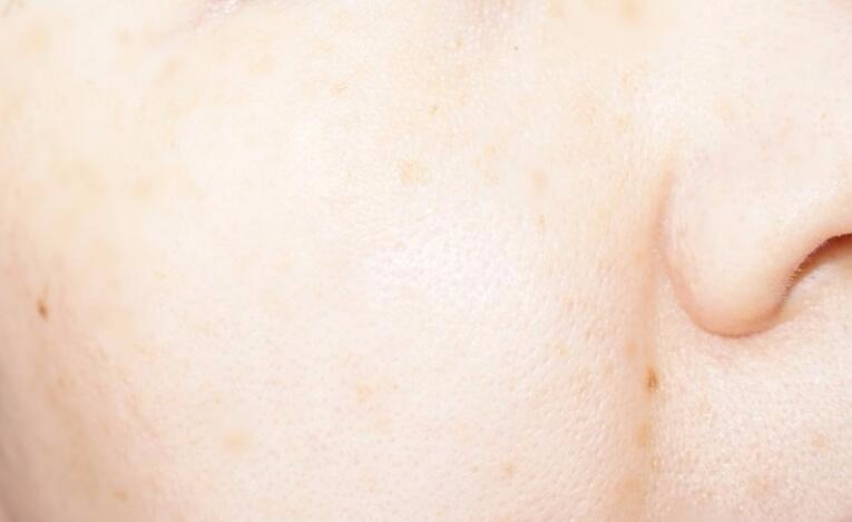 城野医生毛孔细致化妆水搭配精华,城野医生化妆水适合油皮