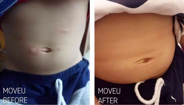 “万用”紫草膏，解决了你多少皮肤烦恼？