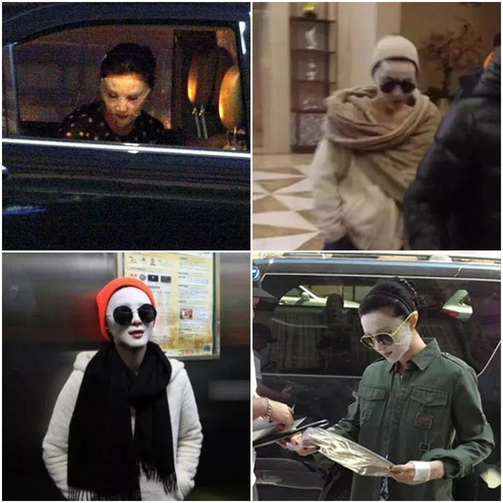 猫砂敷脸、蜜蜂毒疗，女明星怪异美容法真的有效？