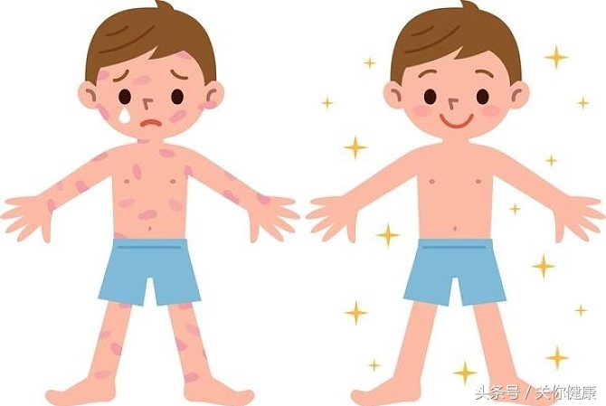 健康每日监测表,怎么样才能避免丹毒的发生