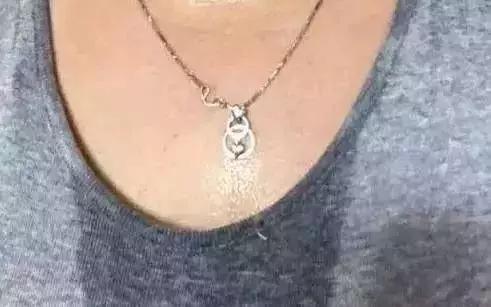 身体出汗是身体什么部位出问题了,哪些部位出汗预示着有啥病