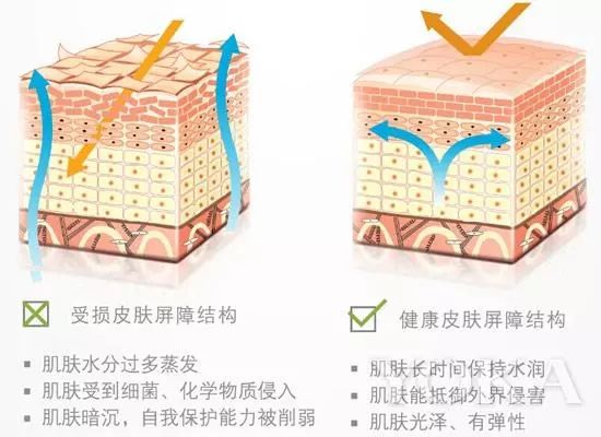 皮肤为什么锁不住水分,皮肤干锁不住水分用什么护肤品
