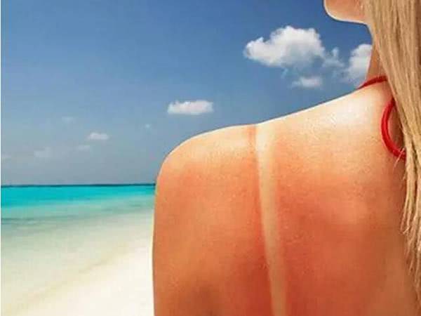 晒后泛红长痘修复最有效的办法,晒后皮肤屏障受损反复长痘怎么办