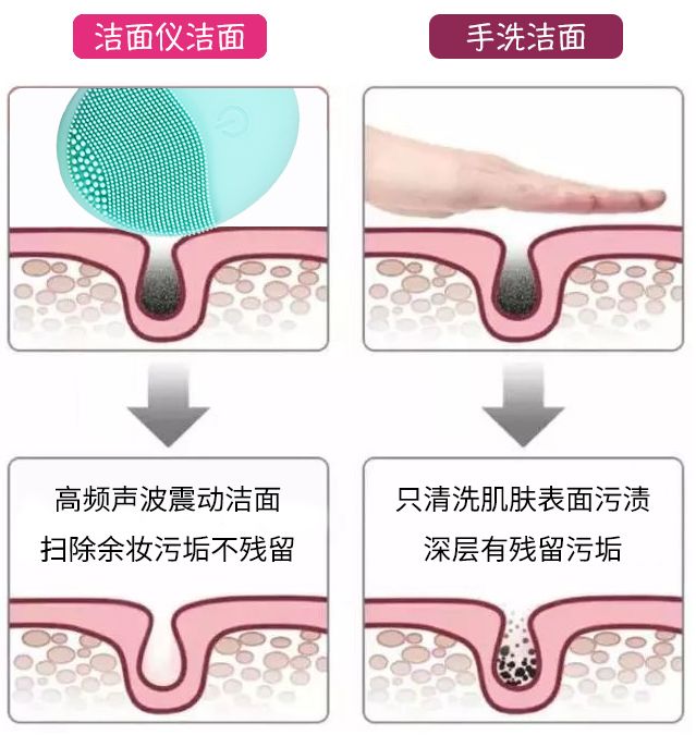 luna洁面仪日版和韩版哪个好,亲测好用四款洁面
