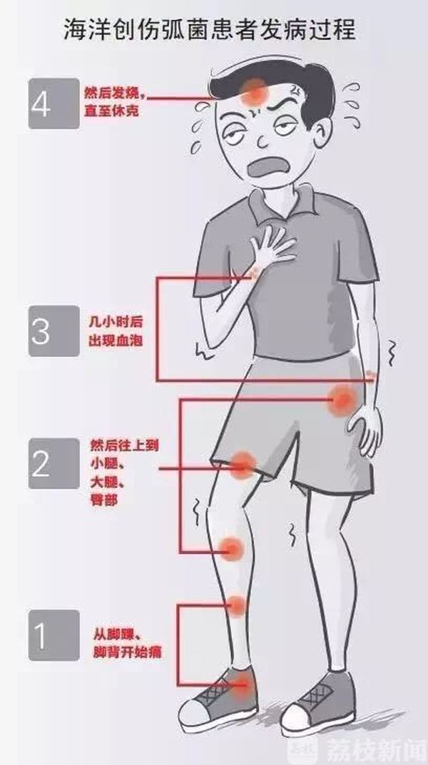 皮皮虾被割伤事件,一男子被虾刺伤