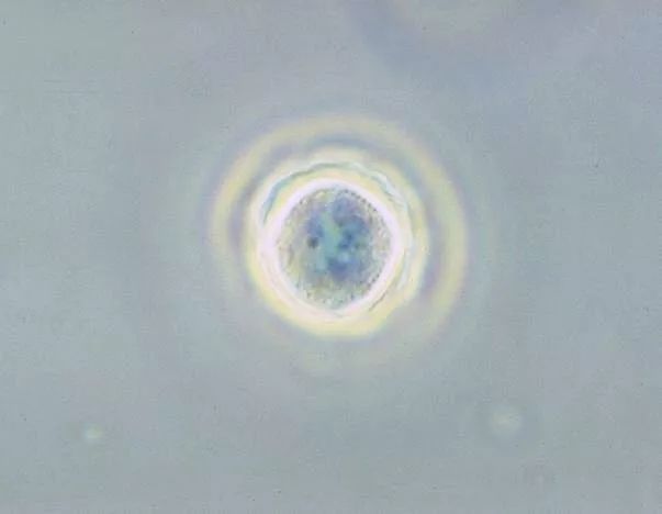 感染食脑虫的人,感染食脑虫的动物