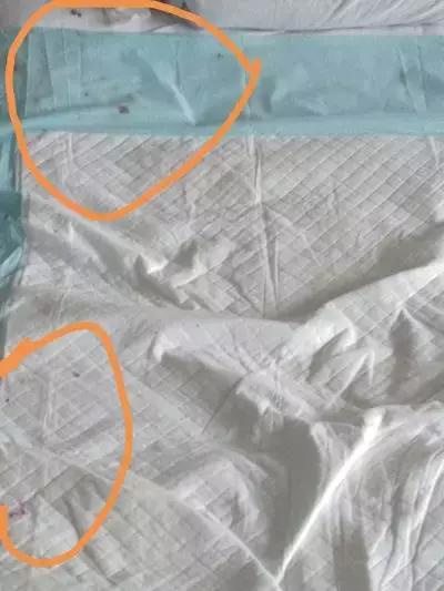 痒痒怎么办用什么药,痒痒怎么办小妙招