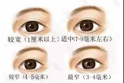 整形的坑不要乱入,整形的风险你知道吗