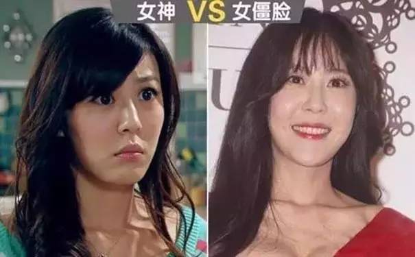 有人劝你打玻尿酸,打玻尿酸的一些常识问题