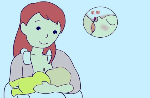 婴儿总是倒气怎么回事,婴儿老是倒奶打嗝怎么回事