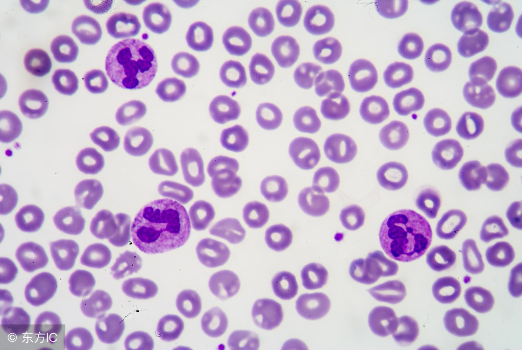 白细胞低中医饮食怎么调理,白细胞偏低要吃什么来调养