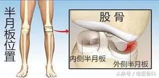 nba半月板损伤都是怎么恢复的,nba球星半月板损伤恢复比较好的