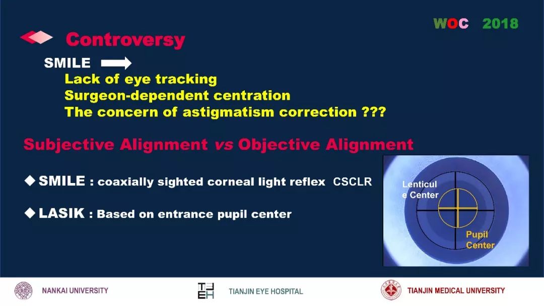 散光治疗技术突破,散光的矫正