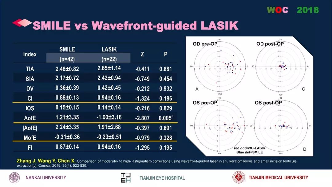 散光治疗技术突破,散光的矫正