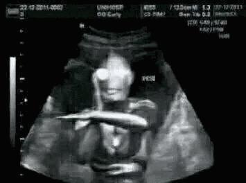 怀孕的搞笑b超图,怀孕了想睡觉表情包