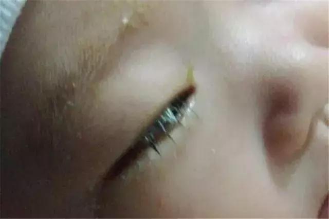 宝宝吃了清火的药晚上出很多汗,婴儿吃了清火宝以后总是哭