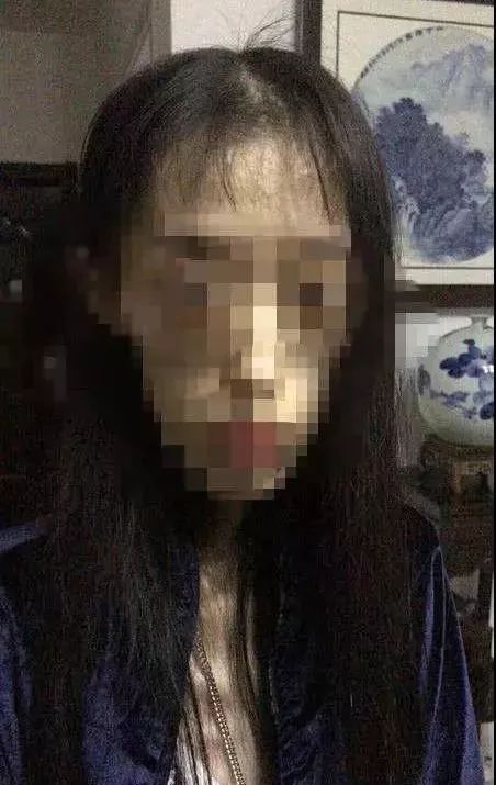 身高1.67米体重只有50斤！看完她的故事，你还敢“自杀式”减肥吗？