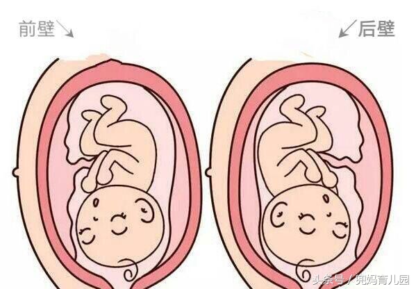 胎盘后壁和胎盘前壁孕妇的区别,胎盘后壁和胎盘前壁的区别是什么