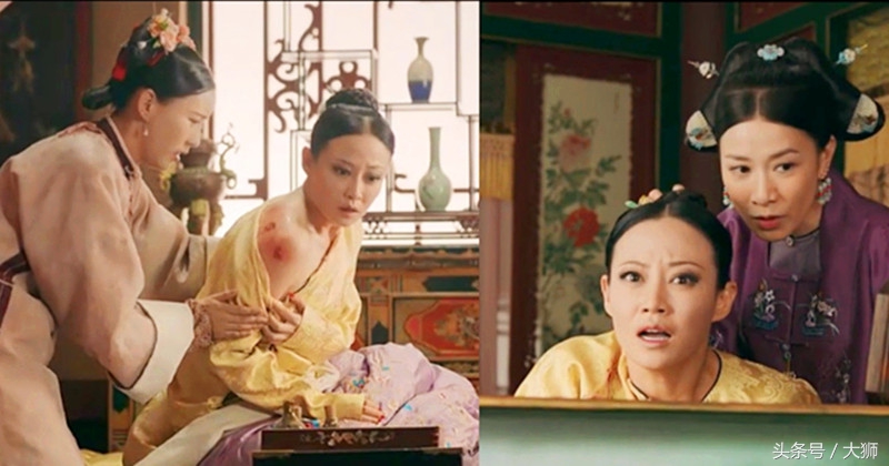延禧攻略贵妃被泼金汁,延禧攻略高贵妃被金汁烫伤片段