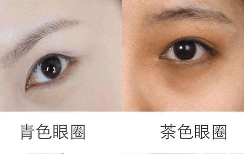 漂亮的人都睡了,用天价护肤品的你却毁容了!