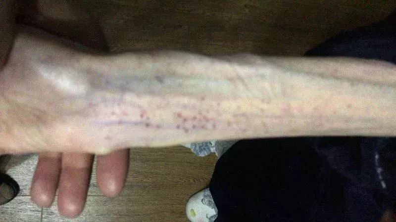 1米67才50斤!看完这个21岁女孩的故事,你还敢“自杀式”减肥吗?