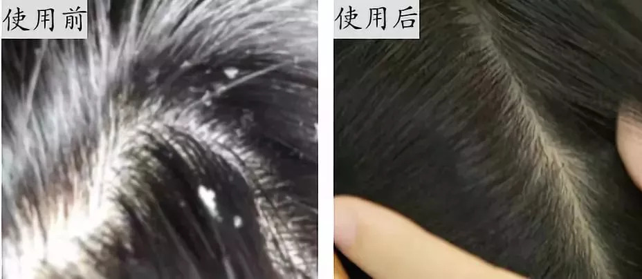 哪些洗发水中有危害成分,有哪些成分的洗发水要避雷