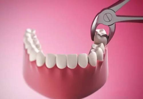 超实用的拔牙小技巧有哪些,拔牙知识图片