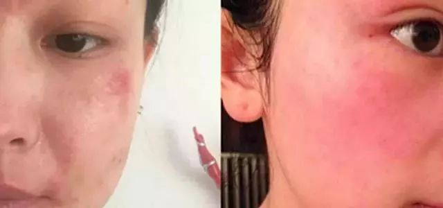 正宗泰国香米皂,泰国美白大米手工皂