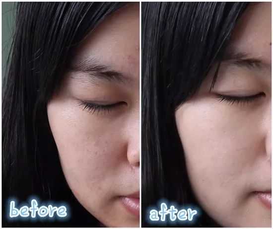 30岁眼角笑起来有皱纹,眼角笑起来有皱纹是老了吗