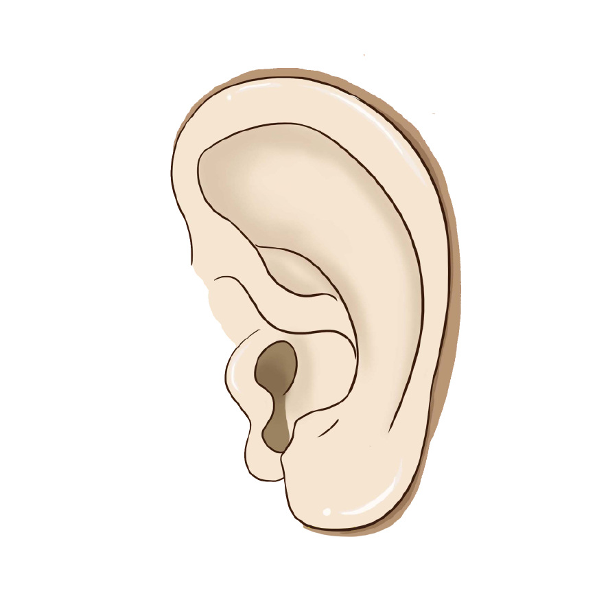 宝宝耳朵耳屎太硬担心掏到耳膜,看到宝宝耳朵里面有耳屎怎么办