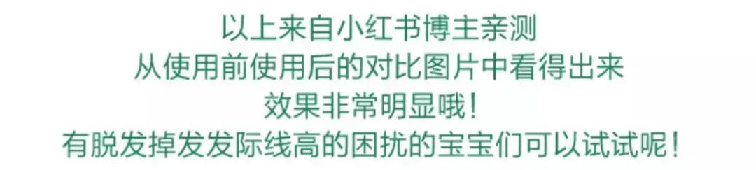 发际线高脱发用什么洗发水,发际线高掉头发洗发水测评