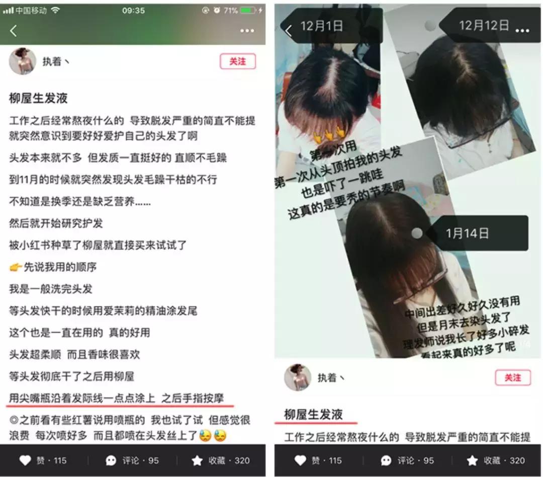发际线高脱发用什么洗发水,发际线高掉头发洗发水测评