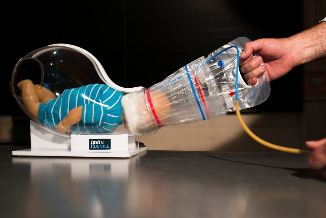 一个汽车修理工的创新，葡萄酒瓶的软木塞让他发明了生孩子的工具