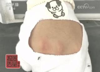 测评驱蚊贴防不防蚊,驱蚊贴超有效