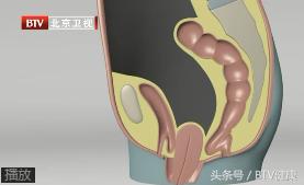 子宫老是往下跑,子宫到处跑是怎么回事